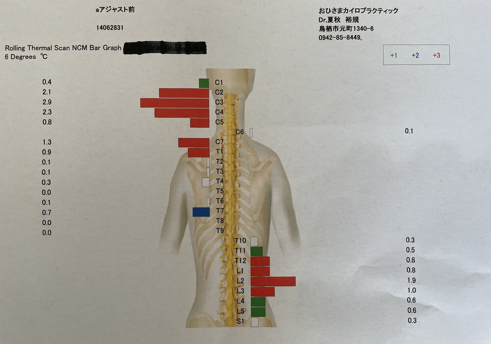 施術前