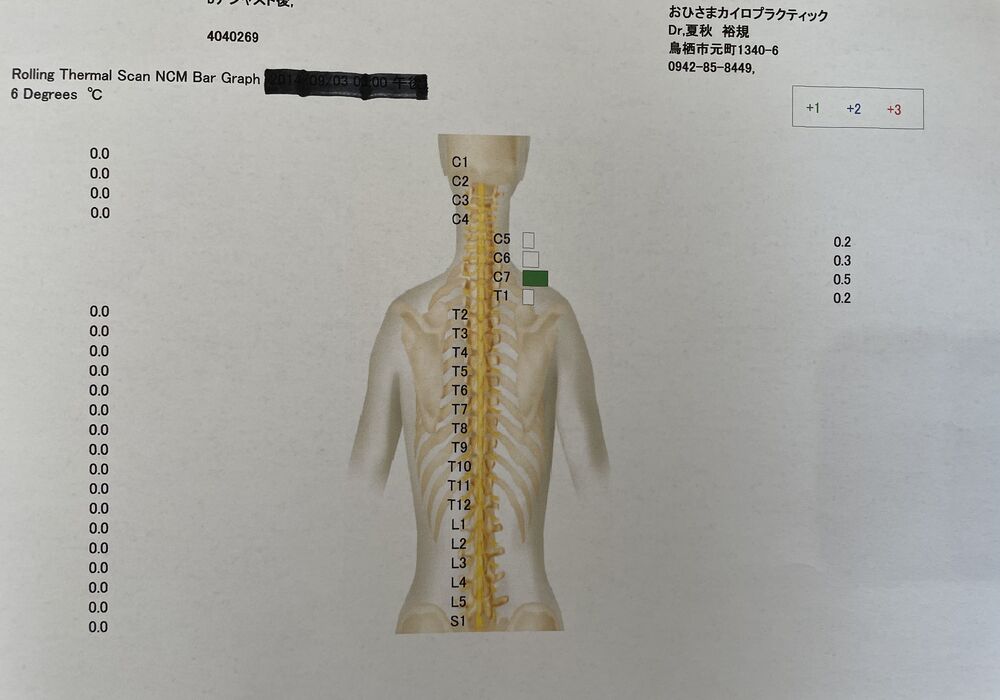 施術後